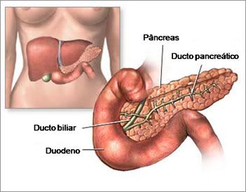 cancer de pancreas