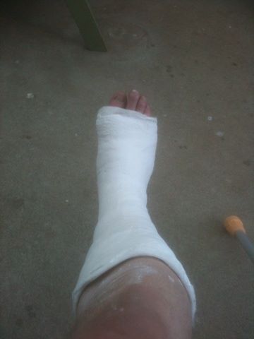 BrokenFootOct2013_zps458508b9.jpg