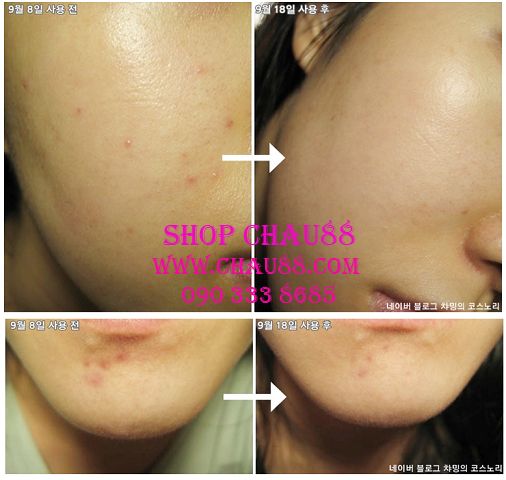 Mỹ Phẩm The Skinfood - Tonymoly - The Face Shop - 3