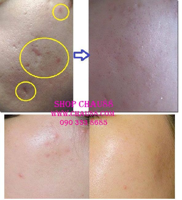 Mỹ Phẩm The Skinfood - Tonymoly - The Face Shop - 7