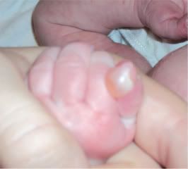 clear fluid filled bumps on hands - Top Doctor Insights on ...